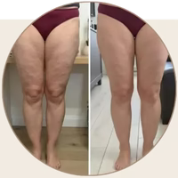 Luisa T. 46 años