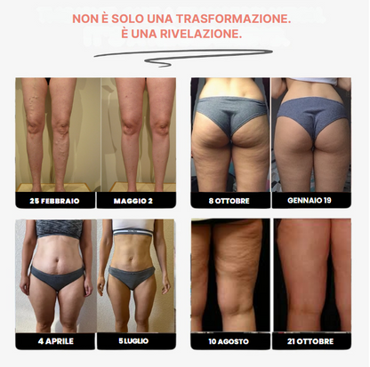 Leggings 3D de Kendal Beauty™ – Anticelulitis - Redefine tu Celulitis sin esfuerzo