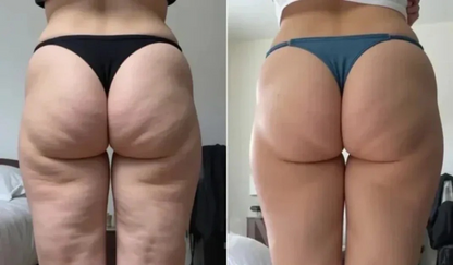 Leggings 3D de Kendal Beauty™ – Anticelulitis - Redefine tu Celulitis sin esfuerzo