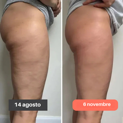 Leggings 3D de Kendal Beauty™ – Anticelulitis - Redefine tu Celulitis sin esfuerzo